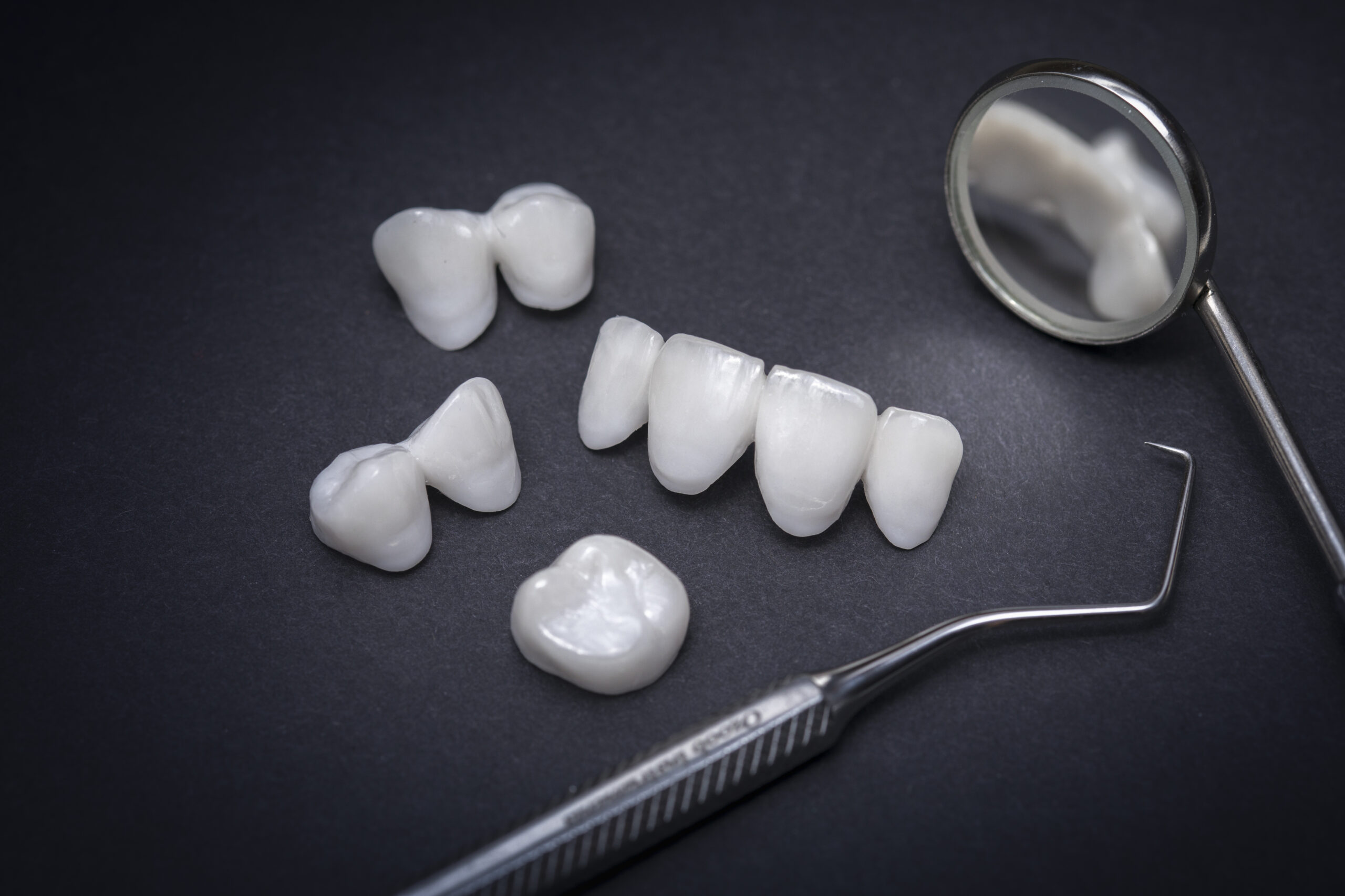 Dentists Are Seeing a Rise in Veneers For Young People, Going Hand in